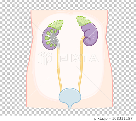 腎臓、kidney 、尿管、膀胱、bladder、イラスト、illustration 腎臓、kidney 、尿管、膀胱、bladder、イラスト、illustration 108331187