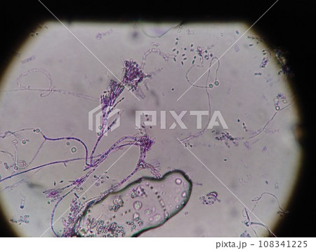 カマンベールチーズを作るカビの顕微鏡写真 カマンベールチーズを作るカビの顕微鏡写真 108341225