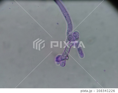テンペ菌の胞子が伸びているところ 108341226