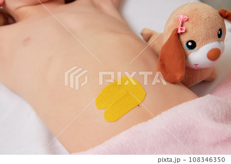 Children belly with glued elastic therapeutic tape, kinesio taping 108346350