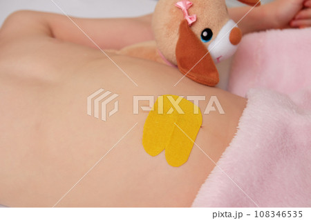 Children belly with glued elastic therapeutic tape, kinesio taping 108346535