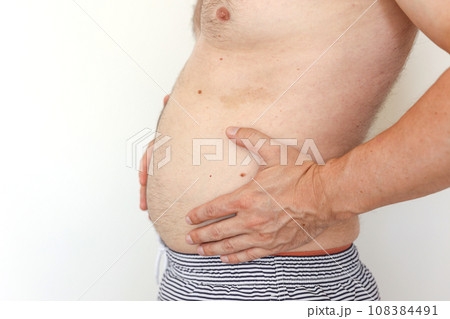 Cropped photo of man is touching his naked not fit belly waistline with loose skin suffering from extra weight. Concept of unhealthy eating and lifestyle, health problems of obese people. 108384491
