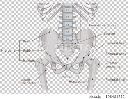 pelvis, pelvis, lumbar vertebrae, lumbar vertebrae, femur, femur, fracture, illustration 108481712
