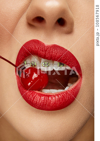 Cropped photo. Close up of woman in braces on teeth with red lips blowing smoke from mouth. Bad habits. No smoking or quit smoking. 108567918