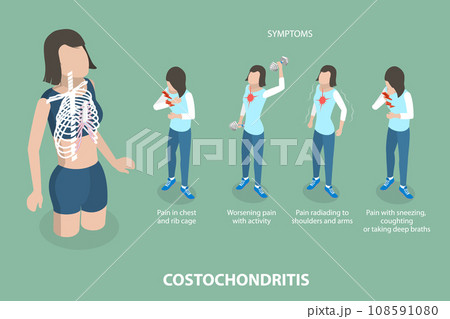 3D Isometric Flat Vector Illustration of Costochondritis 108591080