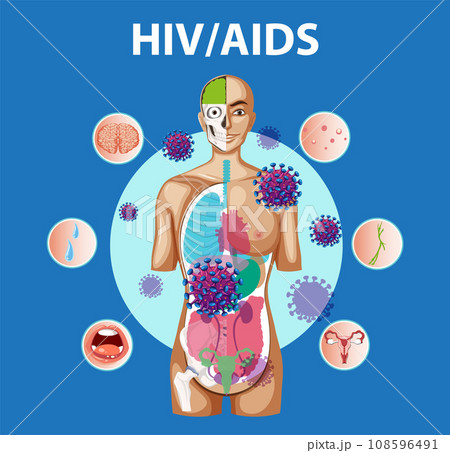 HIV/AIDS Virus: Effects on Immune System and Body 108596491