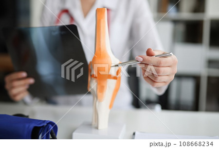 Doctor traumatologist examines x-ray and legs and the model of knee joint 108668234