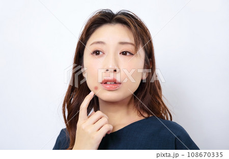 ニキビに悩む女性イメージ 108670335