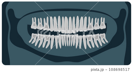 Panoramic dental X-Ray. 32 healthy tooth on x-ray. Vector illustration. 108698517