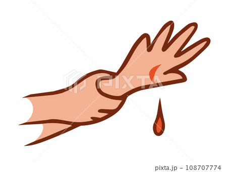 Domestic injury 108707774
