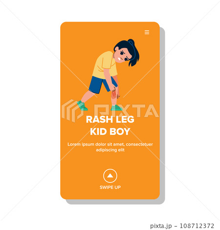 rash leg kid boy vector 108712372