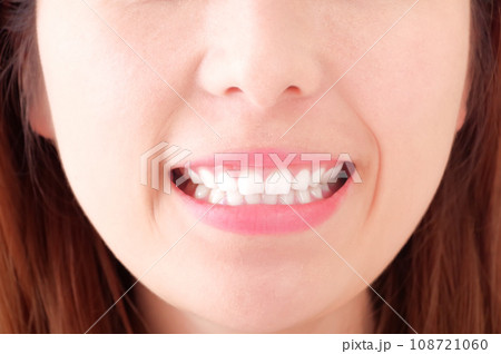 笑顔で歯を強調する若い女性 108721060