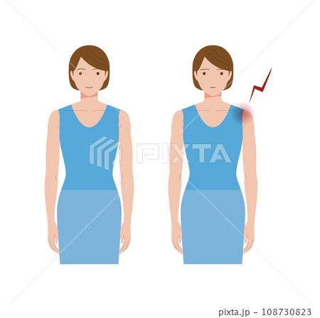 凍結肩、四十肩、五十肩、関節周囲炎で肩が痛む女性 108730823
