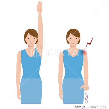 凍結肩、四十肩、五十肩、関節周囲炎で肩が痛み手が上に上がらない女性 108730825
