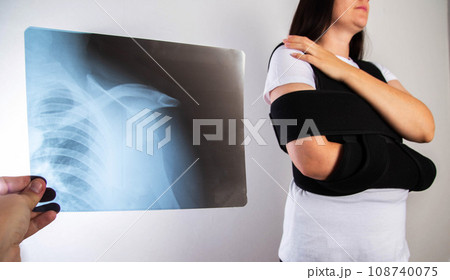 The doctor holds in his hand a medical x-ray of a dislocated humerus and a fractured collarbone against the background of a girl patient whose shoulder hurts. Fixing bandage for the shoulder joint. The doctor holds in his hand a medical x-ray of a dislocated humerus and a fractured collarbone against the background of a girl patient whose shoulder hurts. Fixing bandage for the shoulder joint. 108740075