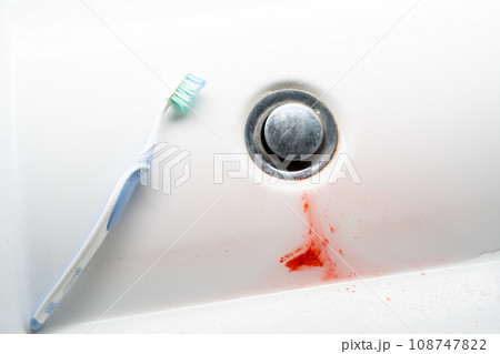 Toothbrush in a white washbasin with blood. Problem with gums 108747822