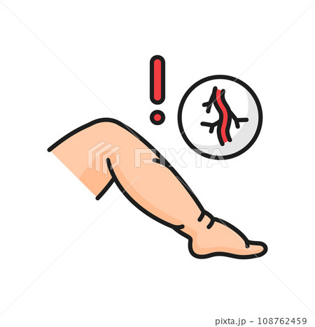 Venous disease edema color line line icon. Vector varicose vein and attention sign. Vascular mesh on legs. Venous edema, hypoproteinemia treatment disease 108762459