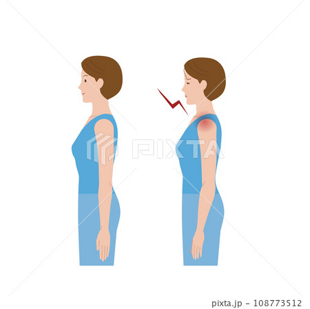 凍結肩,四十肩,五十肩,関節周囲炎で肩が痛む女性 108773512