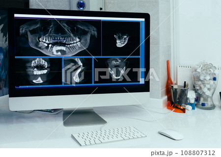 X ray image of a computer in a dentist's office X ray image of a computer in a dentist's office 108807312