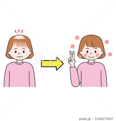 FAGA　頭頂部と前髪の薄毛の治療に成功した女性　ピース 108827097