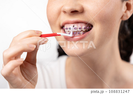 Close up of young Caucasian woman with brackets on teeth cleaning interdental space using orthodontic toothbrushes. White background. Concept of dental care during orthodontic treatment Close up of young Caucasian woman with brackets on teeth cleaning interdental space using orthodontic toothbrushes. White background. Concept of dental care during orthodontic treatment 108831247