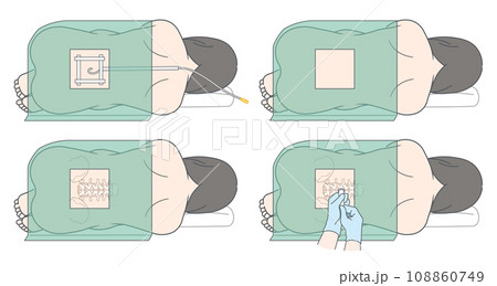 硬膜外麻酔・くも膜下麻酔・無痛分娩のイラスト 108860749