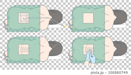 硬脊膜外麻醉、蜘蛛網膜下腔麻醉及無痛分娩圖示 108860749