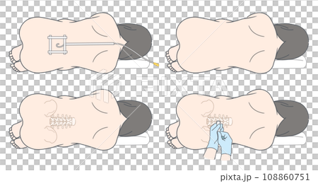 硬膜外麻酔・くも膜下麻酔・無痛分娩のイラスト 108860751