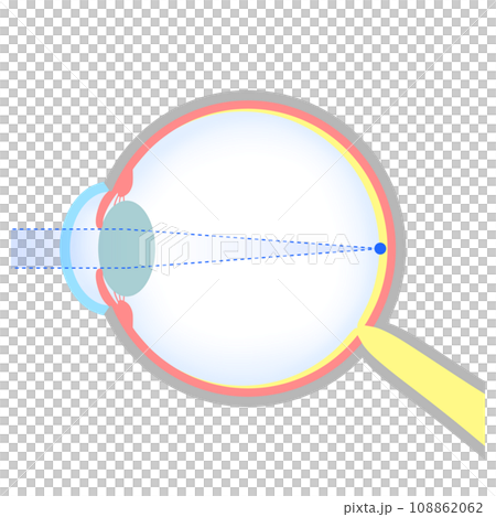 Illustration of normal eyeball (emmetropia) Illustration of normal eyeball (emmetropia) 108862062