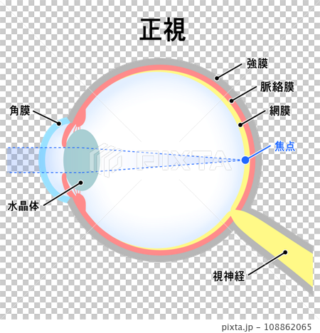 Illustration of normal eyeball (emmetropia) Illustration of normal eyeball (emmetropia) 108862065