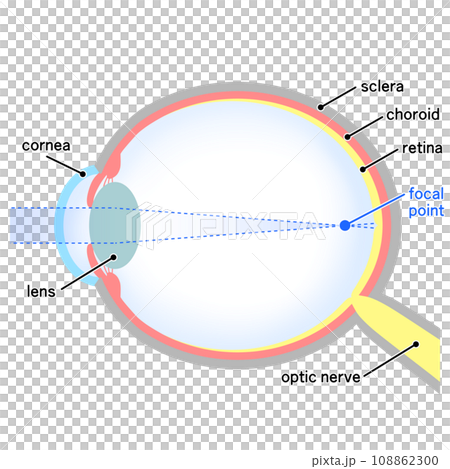 軸性近視眼球的插圖 108862300