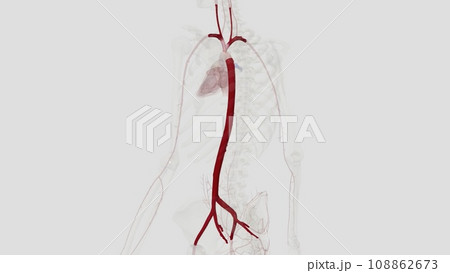 The largest artery in the body is the aorta and it is divided into four parts: ascending aorta, aortic arch, thoracic aorta, and abdominal aorta The largest artery in the body is the aorta and it is divided into four parts: ascending aorta, aortic arch, thoracic aorta, and abdominal aorta 108862673