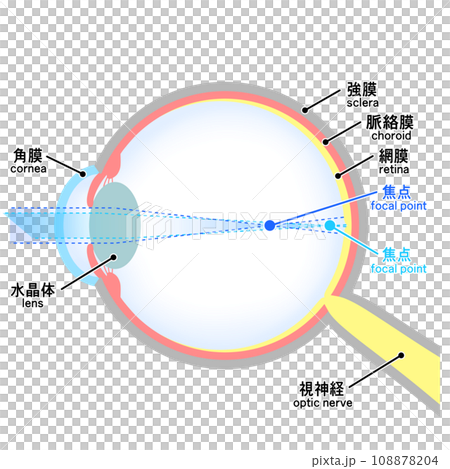 近視正乱視の眼球のイラスト 近視正乱視の眼球のイラスト 108878204