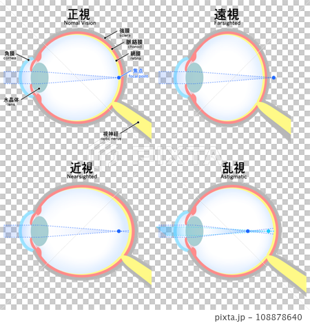 正視・近視・遠視・乱視の眼球のイラストのイラスト素材 [108878640] - PIXTA