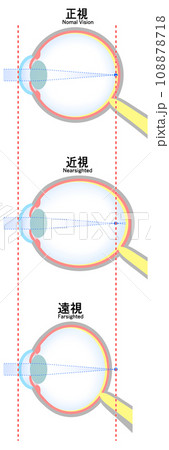 正視・近視・遠視の眼球のイラスト 正視・近視・遠視の眼球のイラスト 108878718