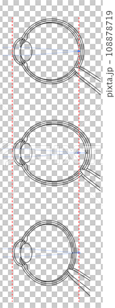 正視・近視・遠視の眼球のイラスト 正視・近視・遠視の眼球のイラスト 108878719