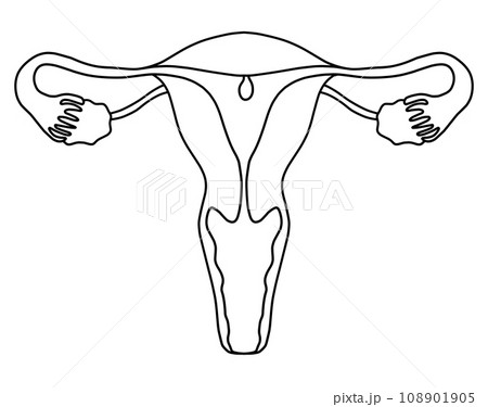 子宮内膜ポリープと子宮頚管ポリープのイラスト 108901905