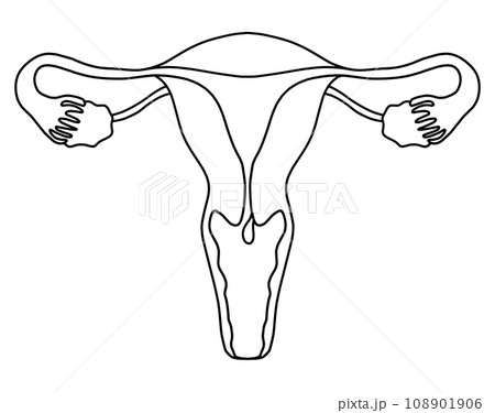 子宮内膜ポリープと子宮頚管ポリープのイラスト 108901906