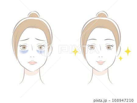 目のクマ　ビフォーアフター 108947210