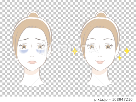 Dark circles before and after Dark circles before and after 108947210