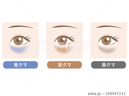 目のクマの種類 108947212