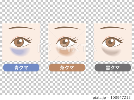目のクマの種類 108947212