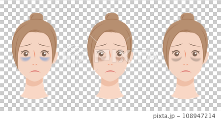 目のクマの種類 目のクマの種類 108947214