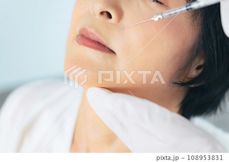 顔に注射を受ける女性　美容整形　ヒアルロン酸　ボトックス注射 108953831