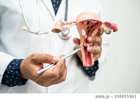 Uterus, doctor holding anatomy model for study diagnosis and treatment in hospital. Uterus, doctor holding anatomy model for study diagnosis and treatment in hospital. 108955981