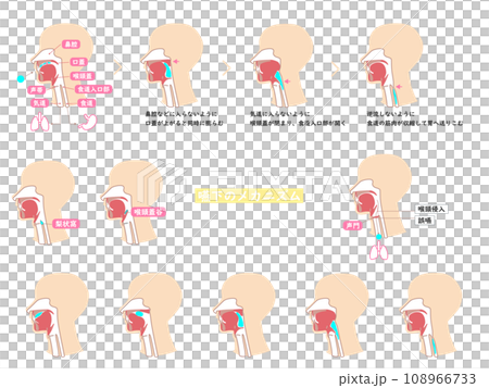 Illustration set 2 with few lines explaining the mechanism of swallowing using cross-sectional diagrams 108966733