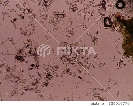 葉の表面に生えたカビの顕微鏡写真 葉の表面に生えたカビの顕微鏡写真 109010770