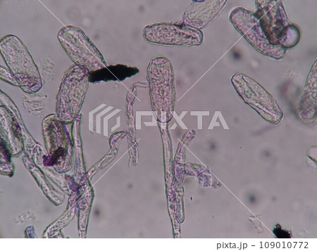 頭に分生子ができたカビの胞子 頭に分生子ができたカビの胞子 109010772