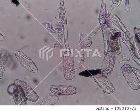 カビの菌糸の先についた分生子 カビの菌糸の先についた分生子 109010773