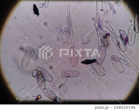 不完全菌類の分生子 不完全菌類の分生子 109020596